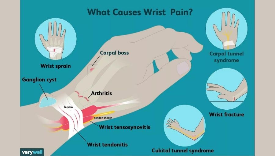 causes of wrist pain